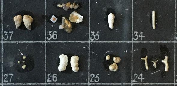 Foraminifera slide from the Charles Elcock collection (Whipple Museum)